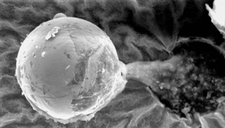 Τι είναι αυτό που ανακαλύψαμε στη στρατόσφαιρα της Γης;