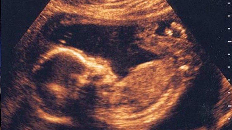 Άδεια σε επιστήμονες να χειριστούν ανθρώπινα έμβρυα για ερευνητικούς σκοπούς