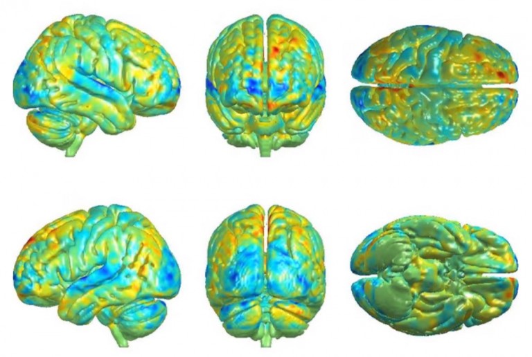 Η Επιρροή της Μουσικής στον Εγκέφαλο …