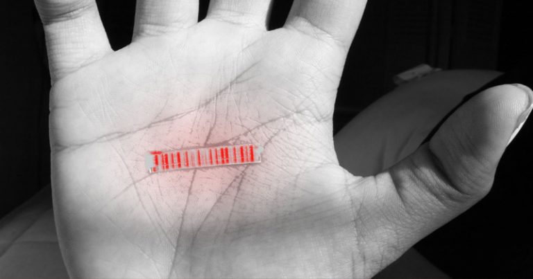 Η ΔΙΑΔΙΚΑΣΊΑ ΤΟΥ ΧΑΡΑΓΜΑΤΟΣ ΣΤΑ ΔΙΑΒΑΤΉΡΙΑ