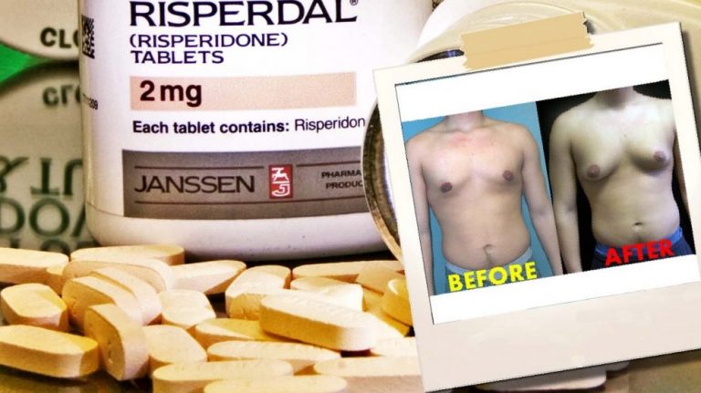 Johnson & Johnson: Βροχή οι μηνύσεις από άντρες για τα στήθη που απέκτησαν από φάρμακο της