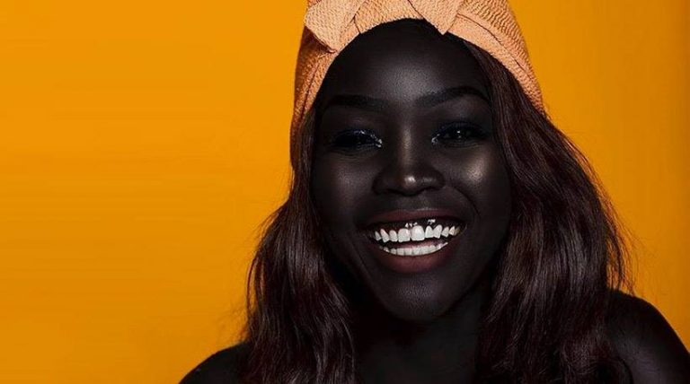 Δείτε την 24χρονη από το Σουδάν που θεωρείται η πιο… μαύρη γυναίκα στον κόσμο