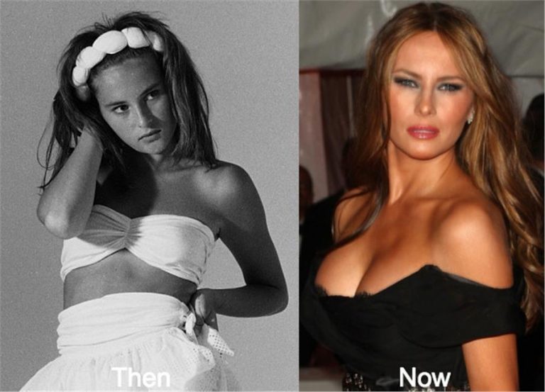 Ρε παιδιά η Μελάνια Τραμπ σας φαίνεται ίδια;