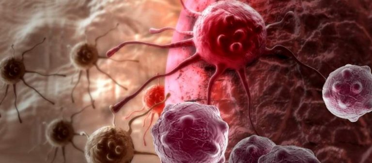 Έλληνας ερευνητής και η ομάδα του κατάφεραν να «σκοτώσουν» τον καρκίνο του μαστού – Έσωσαν γυναίκα στο τελικό στάδιο!