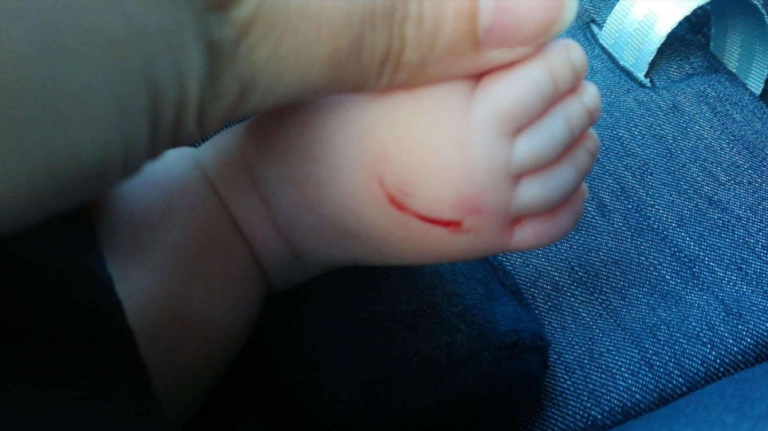 Τρόμος από τη μυστηριώδη γυναίκα που χαρακώνει βρέφη: Δύο ακόμη περιστατικά στα νότια προάστια