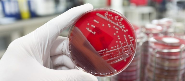 Συναγερμός στις ΗΠΑ για μυστηριώδη ασθένεια που προκαλεί παράλυση