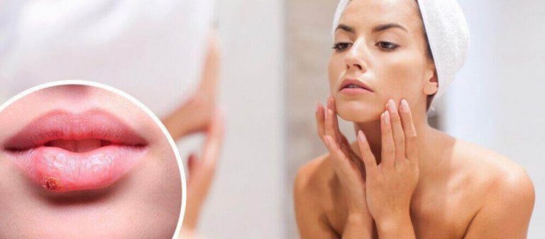 Σημάδια προσώπου που κρύβουν «άσχημα» μυστικά