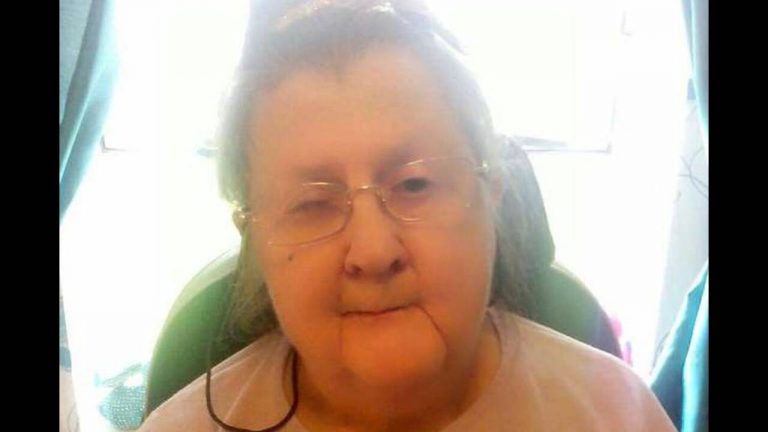 Αδιανόητο: Εισέβαλε στο σπίτι ηλικιωμένης, της έκοψε το χέρι και το πήρε μαζί του