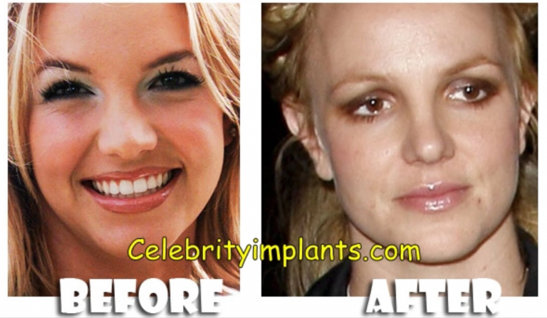 ΤΩΡΑ ΠΟΥ ΕΙΝΑΙ ΚΛΩΝΟΣ ΕΧΕΙ ΛΙΓΟΤΕΡΑ ΨΥΧΟΛΟΓΙΚΑ ΠΡΟΒΛΗΜΑΤΑ;;; ΤΟ ΣΥΜΠΑΝ ΔΕΝ ΣΥΓΧΩΡΑΕΙ ΑΝΩΜΑΛΙΕΣ