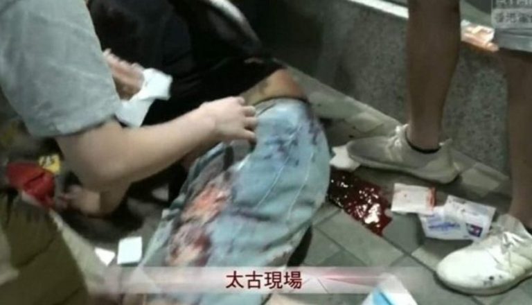 Χονγκ Κονγκ: Πραγματικά πυρά από την αστυνομία κατά των διαδηλωτών