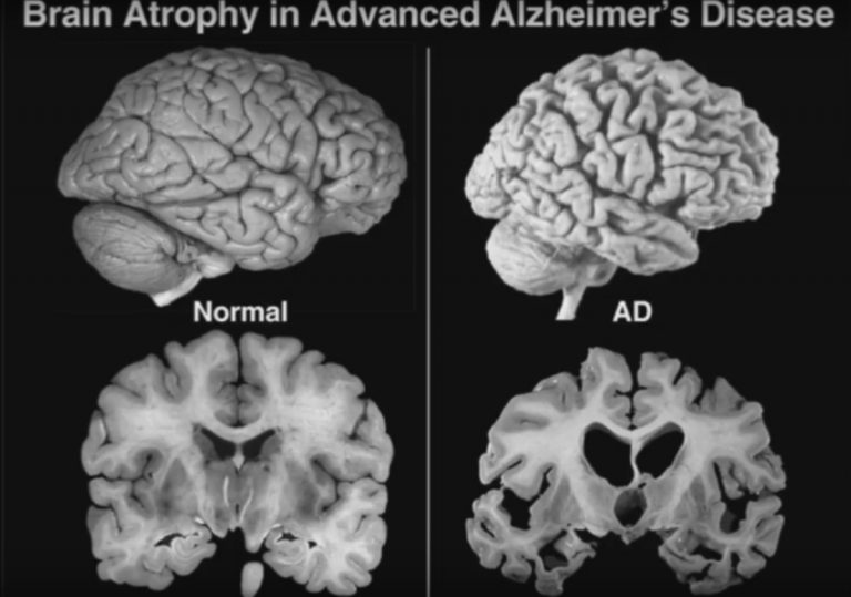 ΣΤΑΤΙΝΕΣ: ΕΤΣΙ Η ΣΕΚΤΑ ΘΑΝΑΤΟΥ ΚΑΤΑΣΤΡΕΦΕΙ ΤΟΝ ΝΟΥ ΤΩΝ ΑΝΘΡΩΠΩΝ