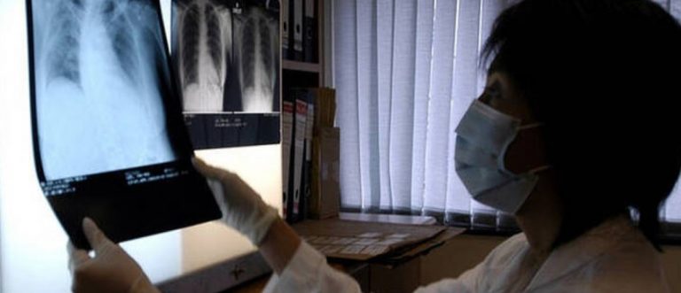 ΠΟΥ για Καζακστάν: Πιστεύουμε πως πολλές περιπτώσεις της «μυστηριώδους» πνευμονίας είναι κορονοϊός