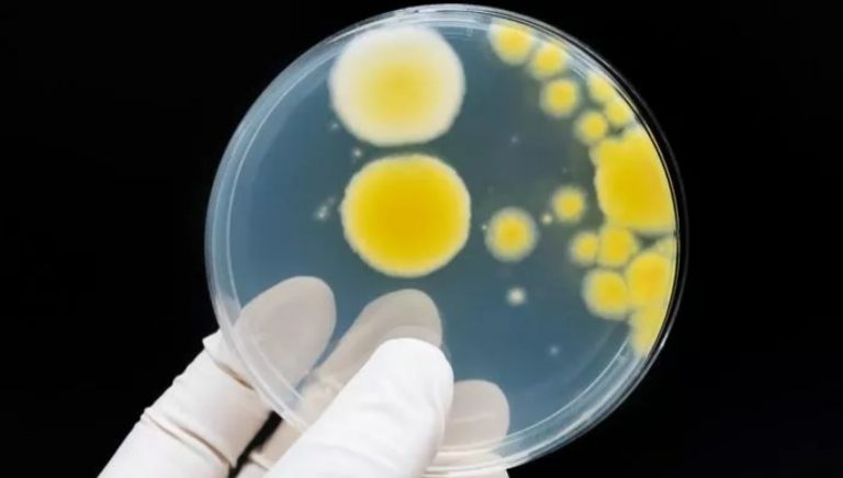 Βρήκε το μυστικό της αθανασίας; Επιστήμονας έγινε… πειραματόζωο με βακτήριο 3,5 εκατομμυρίων ετών!