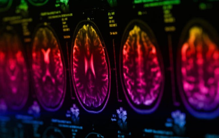 Ούτε λίγο ούτε πολύ, επιστήμονες «ανοιγόκλεισαν» τη συνείδηση σε πιθήκους