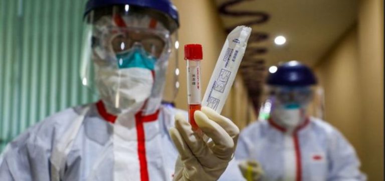 ΠΡΟΣΟΧΗ ΜΕ ΤΟ ΤΕΣΤ COVID-19 ΣΑΣ ΜΕΤΑΔΙΔΟΥΝ ΤΟΝ ΙΟ-ΤΑ ΕΜΒΟΛΙΑ ΔΕΝ ΜΠΟΡΟΥΝ ΝΑ ΘΕΡΑΠΕΥΣΟΥΝ ΜΙΑ ΗΛΕΚΤΡΙΚΗ ΑΣΘΕΝΕΙΑ