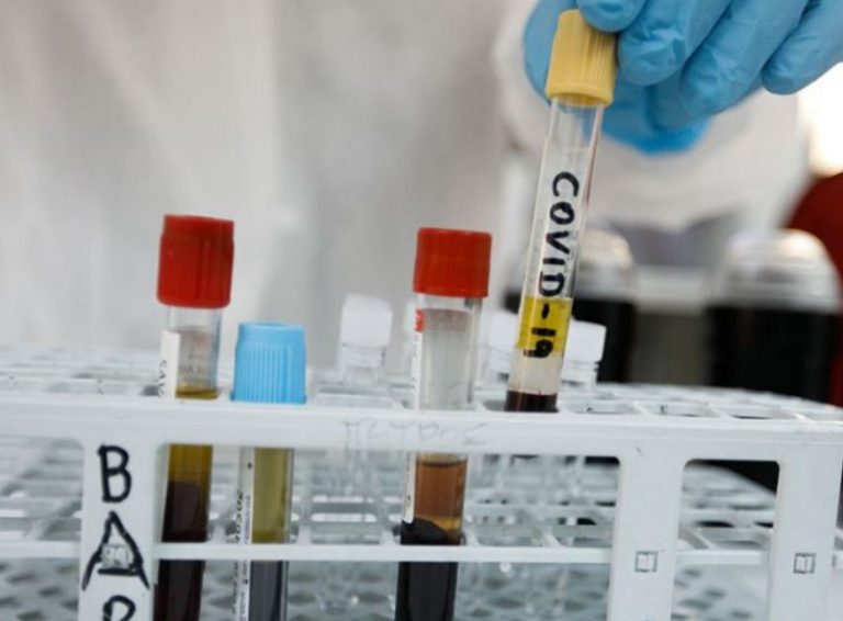 Τα fake news Επαληθεύονται: Προαιρετικό εμβόλιο κατά της φυματίωσης (BCG) απέναντι στον Covid19 από 1 Ιουνίου