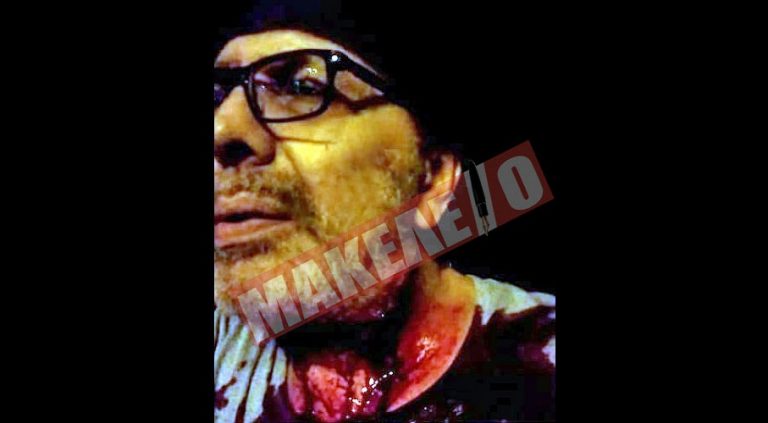 ΣΤΥΓΝΟΙ ΔΟΛΟΦΟΝΟΙ ΠΗΓΑΝ ΓΙΑ ΝΑ ΤΟΝ ΣΚΟΤΩΣΟΥΝ – ΣΩΘΗΚΕ ΕΠΕΙΔΗ ΜΠΛΟΚΑΡΕ ΤΟ ΟΠΛΟ ΤΟΥ ΦΟΝΙΑ – ΔΕΙΤΕ ΤΟΝ ΣΤΕΦΑΝΟ ΧΙΟ ΜΕ ΤΑ ΑΙΜΑΤΑ ΝΑ ΤΡΕΧΟΥΝ ΑΠΟ ΤΟ ΛΑΙΜΟ ΤΟΥ – ΓΙΑ ΘΑΥΜΑ ΜΙΛΟΥΝ ΟΙ ΓΙΑΤΡΟΙ [ΠΡΟΣΟΧΗ ΣΚΛΗΡΕΣ ΦΩΤΟ]