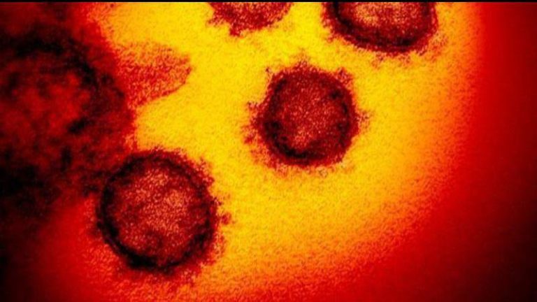 11 new COVID-19 cases, 2 from outbreak in Saskatoon