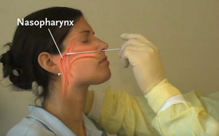 Ανήκουστο! Έκανε ρινικό τεστ κορωνοϊού και της τρύπησαν τον εγκέφαλο!