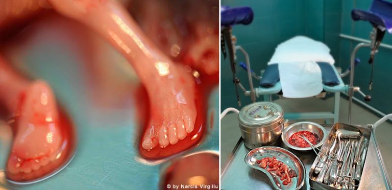 ΤΙ  ΕΤΙ  ΧΡΕΙΑΝ  ΕΧΟΜΕΝ  ΜΑΡΤΥΡΩΝ ;