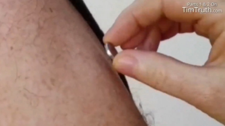 ΕΙΝΑΙ ΙΔΡΩΜΈΝΑ ΤΑ ΧΕΡΙΑ ΣΑΣ ΒΡΕ ΓΙΑ ΑΥΤΌ ΚOLΛΆΕΙ