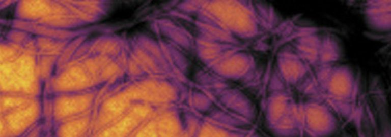 Μέσα στα επόμενα τρία χρόνια η νόσος PRION θα σαρώσει…