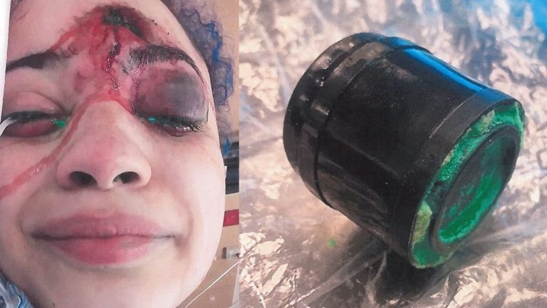 ΜΕΛΒΟΥΡΝΗ…. Η ΔΗΜΟΚΡΑΤΙΑ ΚΑΟΥΤΣΟΥΚ ΒΟΗΘΑΕΙ ΣΤΗΝ ΥΓΕΙΑ – MELBOURNE …. RUBBER REPUBLIC HELPS HEALTH 20/9/21