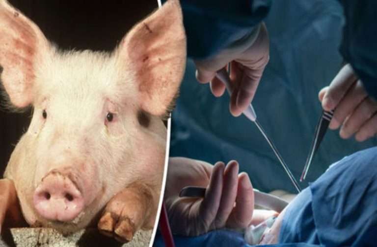 Για πρώτη φορά, γιατροί στις ΗΠΑ συνέδεσαν σε άνθρωπο νεφρό από χοίρο!