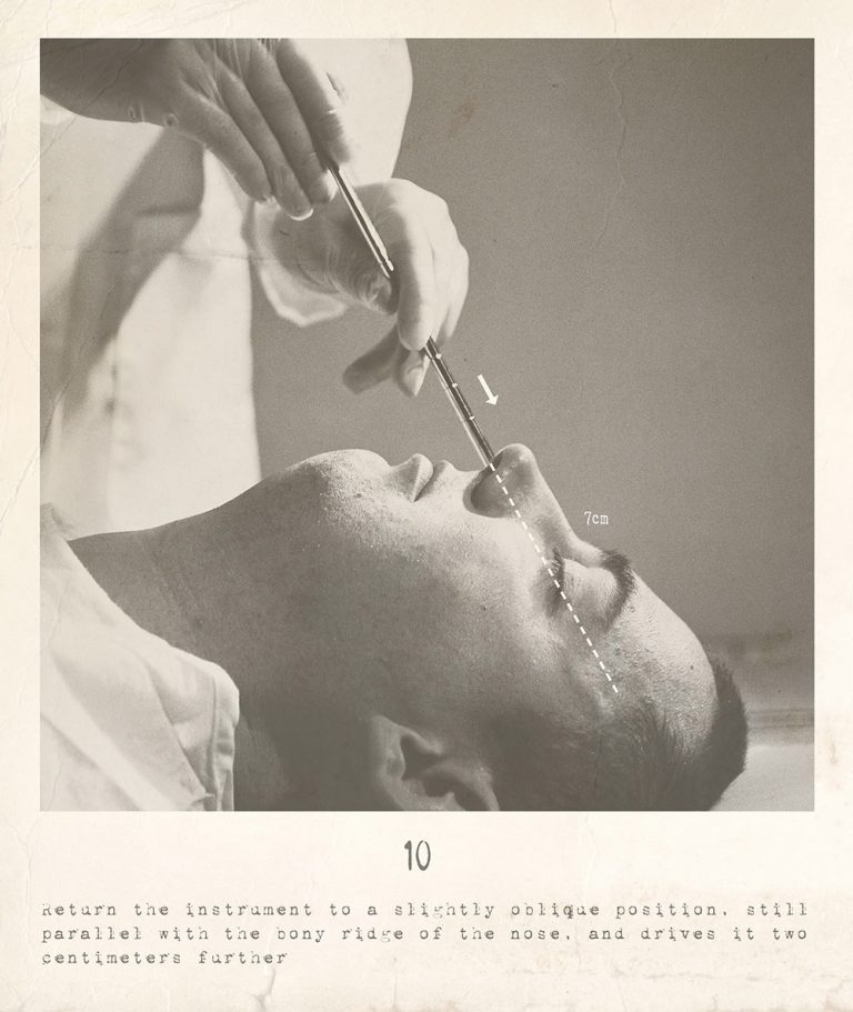 1.Οί «εξωγήϊνοι» Ίνκας έκαναν λοβοτομές από τά ρουθούνια 2.Ό στυλεός τού transslavepass τό κάνει απευθείας καί μέ τ’ οξείδιον αιθυλενίου 3.Είναι η λοβοτομή η ζομποποίηση μέ χειρούργηση ή μέ ραδιοσήματα; 4. Τί κατ’ ακρίβειαν σημαίνει trans sexual;…