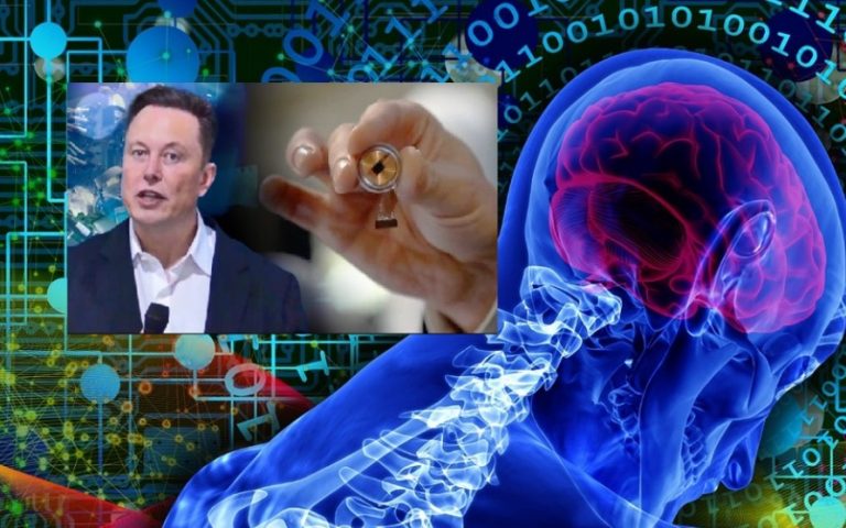 Έλον Μασκ:«Τους επόμενους 6 ΜΗΝΕΣ το ΤΣΙΠΑΡΙΣΜΑ ανθρώπινων εγκεφάλων»!