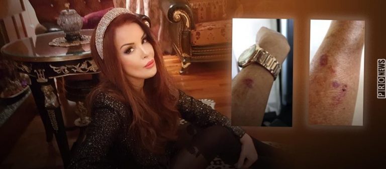 «Έκανα το εμβόλιο και δείτε τι έπαθα»: Η Χρυσηίδα Δημουλίδου δείχνει σε ζωντανή μετάδοση φωτογραφίες-ντοκουμέντο