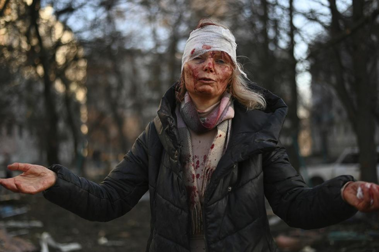 Ηθοποιοί τραυματίες σε πλάνα απο Ουκρανία;Σαν το Ιράκ;