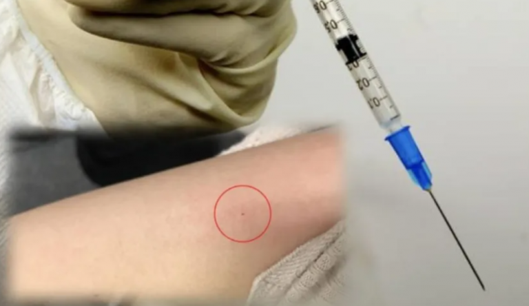 Γαλλία: Μυστήριο από τις επιθέσεις με σύριγγες σε νυχτερινά κέντρα και συναυλίες