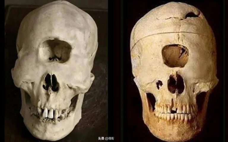 Βρέθηκαν κρανία κυκλώπων στις Φιλιππίνες!