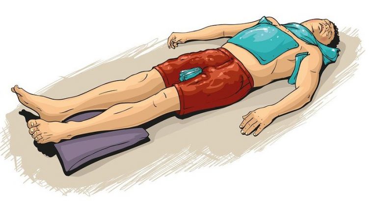 Θερμοπληξία: Δώστε προσοχή σε αυτά τα συμπτώματα