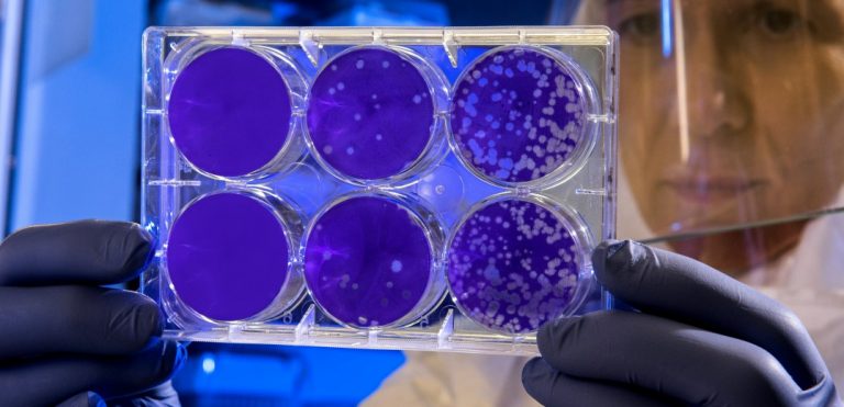 Κούβα: Ιταλός τουρίστας πέθανε από ευλογιά των πιθήκων – Το πρώτο κρούσμα στη χώρα