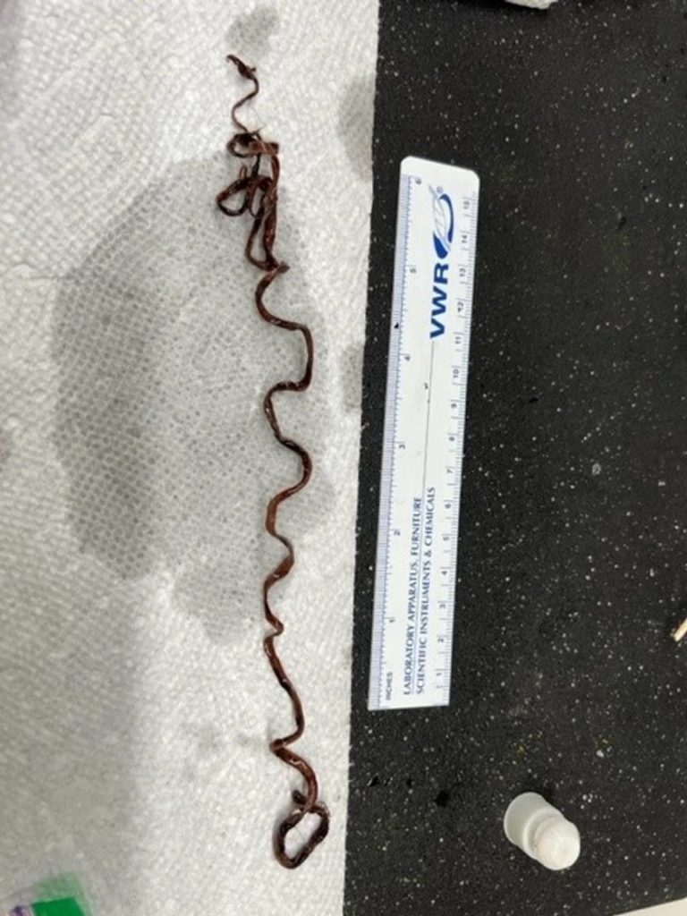 Η ΑΝΘΡΩΠΌΤΗΤΑ ΒΡΊΣΚΕΤΑΙ ΣΕ ΚΊΝΔΥΝΟ ΑΠΟ ΤΟΥΣ ΘΡΌΜΒΟΥΣ ΤΈΡΑΤΑ ΣΤΑ ΣΏΜΑΤΑ ΤΡΥΠΗΜΈΝΩΝ – ΟΙ ΕΙΔΙΚΟΊ ΦΟΒΟΎΝΤΑΙ ΝΑ ΜΙΛΉΣΟΥΝ