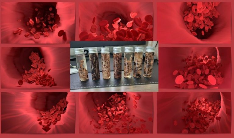 «Είναι σαν ΓΑΙΟΣΚΩΛΗΚΑΣ»! Αυτά βλέπουν γραφεία κηδειών σε νεκρούς: «ΚΑΤΙ ΞΕΝΟ ΣΧΗΜΑΤΙΖΕΙ ΤΟΥΣ ΘΡΟΜΒΟΥΣ»