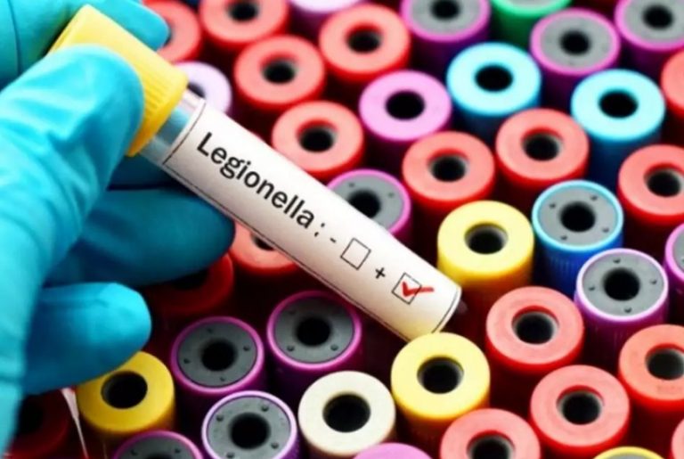 Αργεντινή: Σε “βακτήριο λεγιονέλλας” οφείλεται η πνευμονία από την οποία πέθαναν τέσσερις άνθρωποι