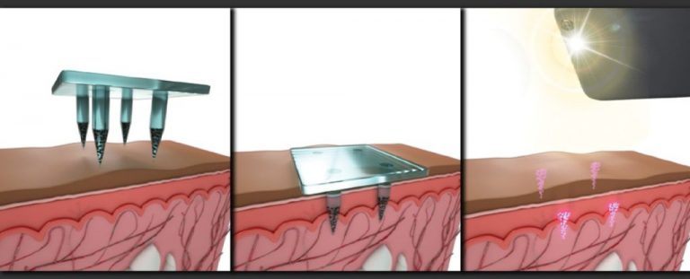 Joshua Philipp-Η Λουσιφεράση ίσως χρησιμοποιηθεί για να ξεχωρίζουν οι υπάκουοι εμβολιασμένοι