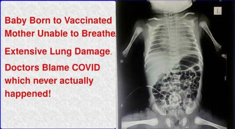 ΤΡΥΠΗΜΈΝΗ ΜΗΤΈΡΑ ΓΕΝΝΆΕΙ ΜΩΡΌ ΜΕ «ΛΕΥΚΟΎΣ ΠΝΕΎΜΟΝΕΣ»