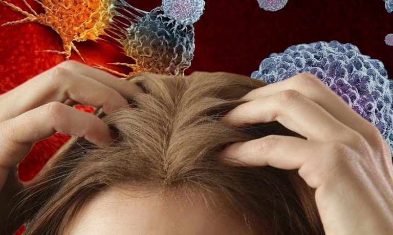 Σαμπουάν: Εντοπίστηκε καρκινογόνος ουσία σε γνωστά προϊόντα