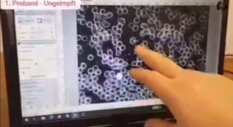 ΣΟΚ: ΔΙΑΦΟΡΑ ΑΙΜΑΤΟΣ ΕΜΒΟΛΙΑΣΜΕΝΩΝ ΚΑΙ ΑΝΕΜΒΟΛΙΑΣΤΩΝ