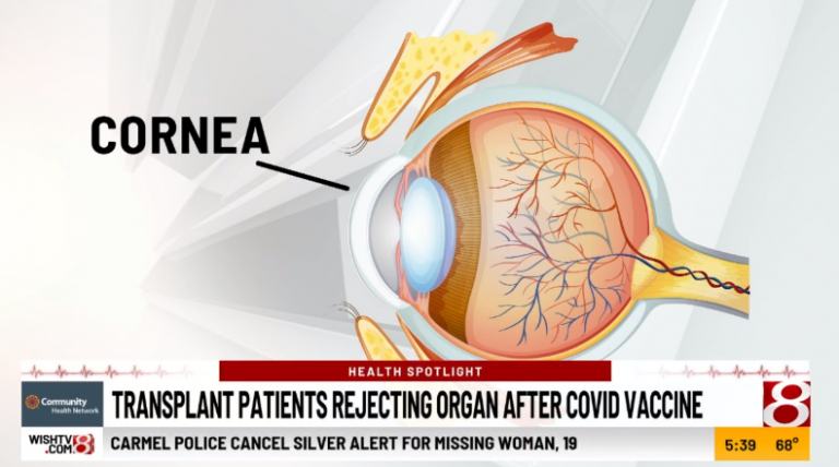 Μελέτη έδειξε ολική απόρριψη μοσχευμάτων μετά τον εμβολιασμό έναντι του κορωνοϊού