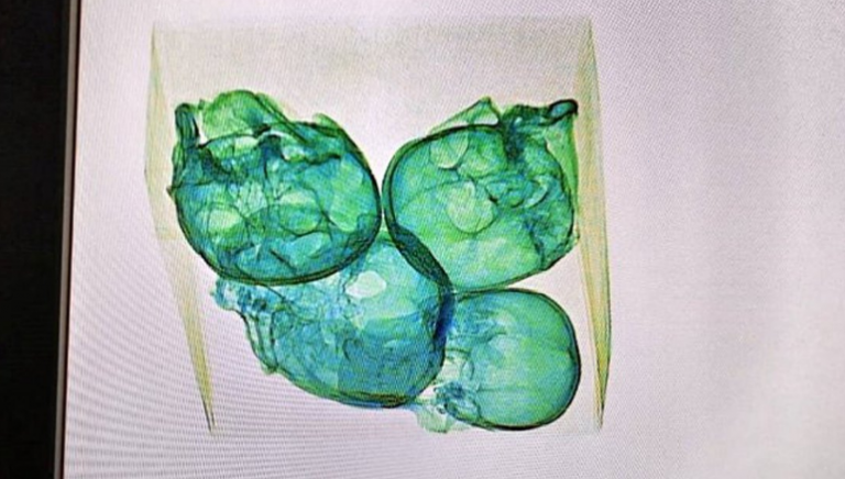 Μεξικό: Εντοπίστηκαν ανθρώπινα κρανία σε δέμα με προορισμό τις ΗΠΑ