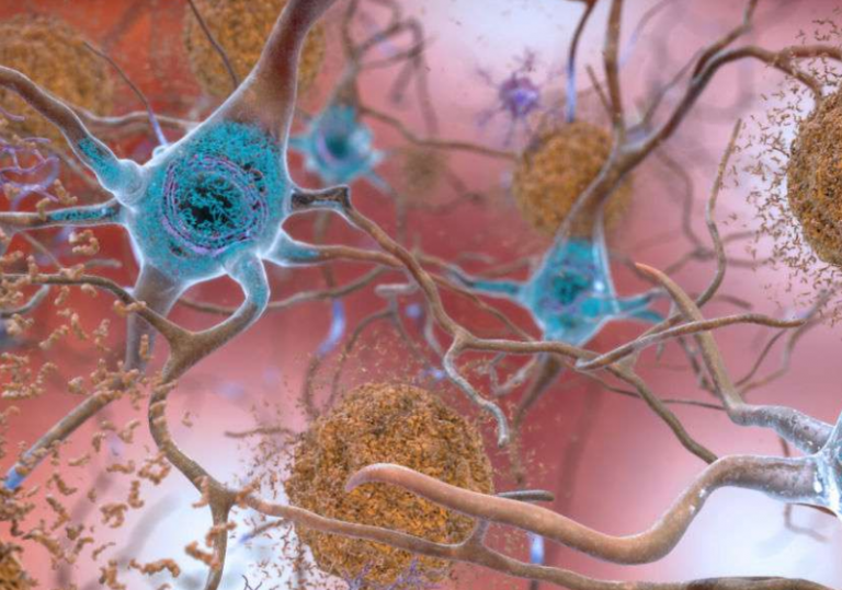 «ΠΟΤΕ ΞΑΝΑ τέτοιοι θρόμβοι αίματος»! Γιατρός δείχνει, εξηγεί και σοκάρει