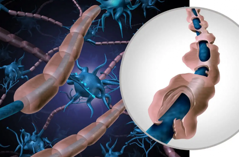 Τραγικό και αληθινό: Το CDC επιβεβαιώνει πως τα εμβόλια Covid πυροδοτούν σύνδρομο παράλυσης Guillain-Barré