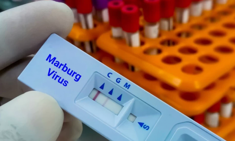 Σε εγρήγορση ο ΠΟΥ για τον ιό Μάρμπουργκ