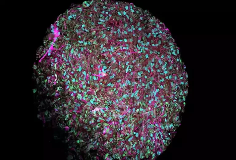 Τεχνητή νοημοσύνη τέλος: Έρχεται η «οργανοειδής νοημοσύνη» λένε οι επιστήμονες