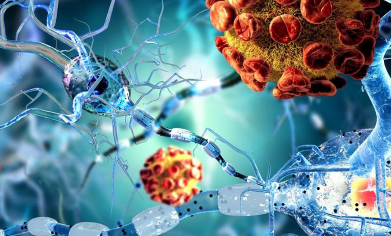 Steve Kirsch: «Οι εμβολιασμένοι, έχουν 25 φορές περισσότερες πιθανότητες να αποκτήσουν αυτοάνοση διαταραχή»!